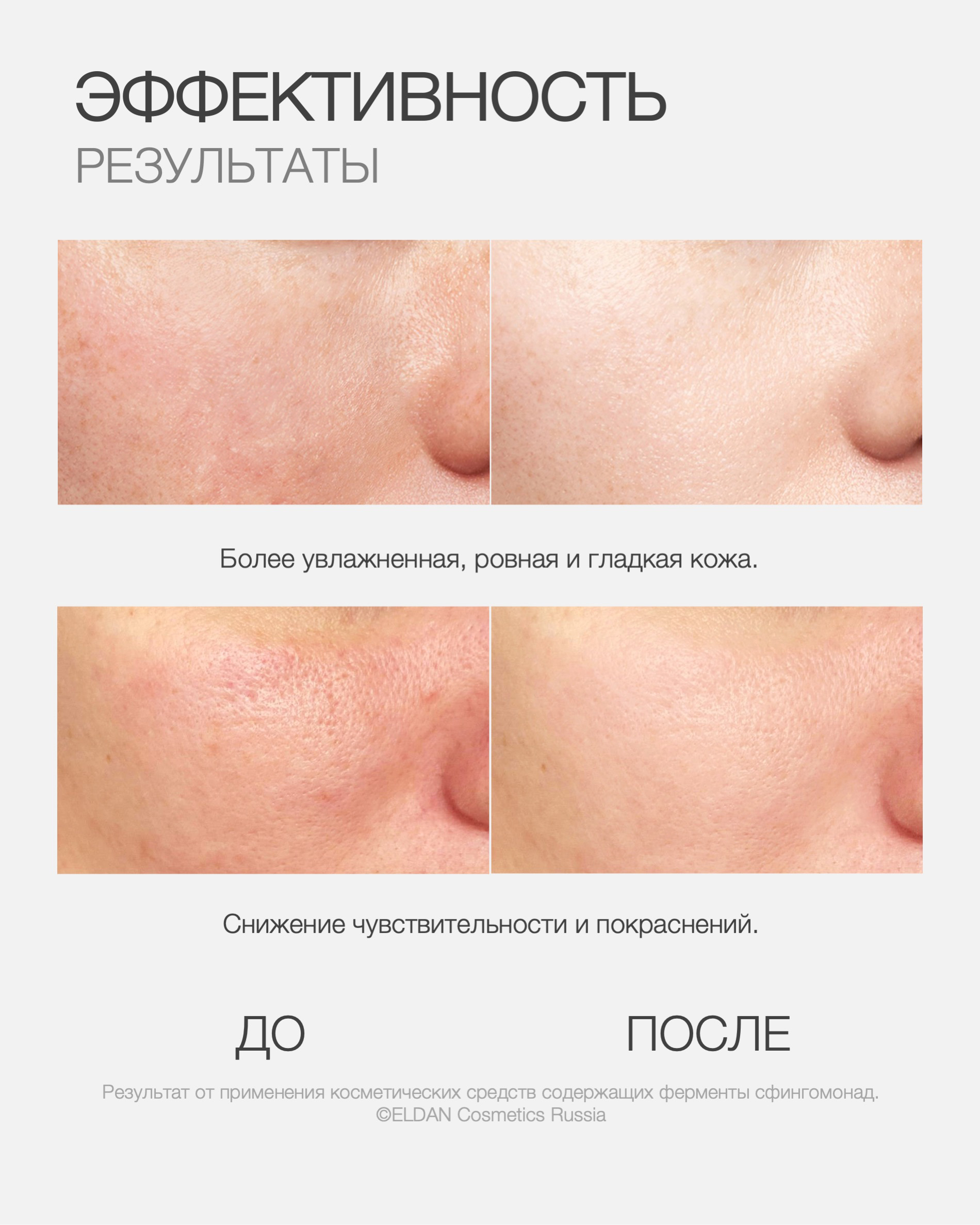 Пост сфингомонад 4.jpg